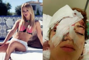 17-årig marockan gripen för misshandeln av Nicole Zanlith